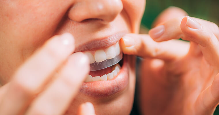 woman placing teeth whitening strips